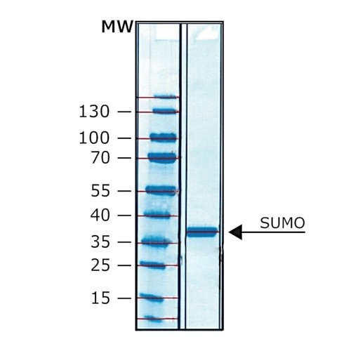 SUMO Protease | سومو پروتئاز